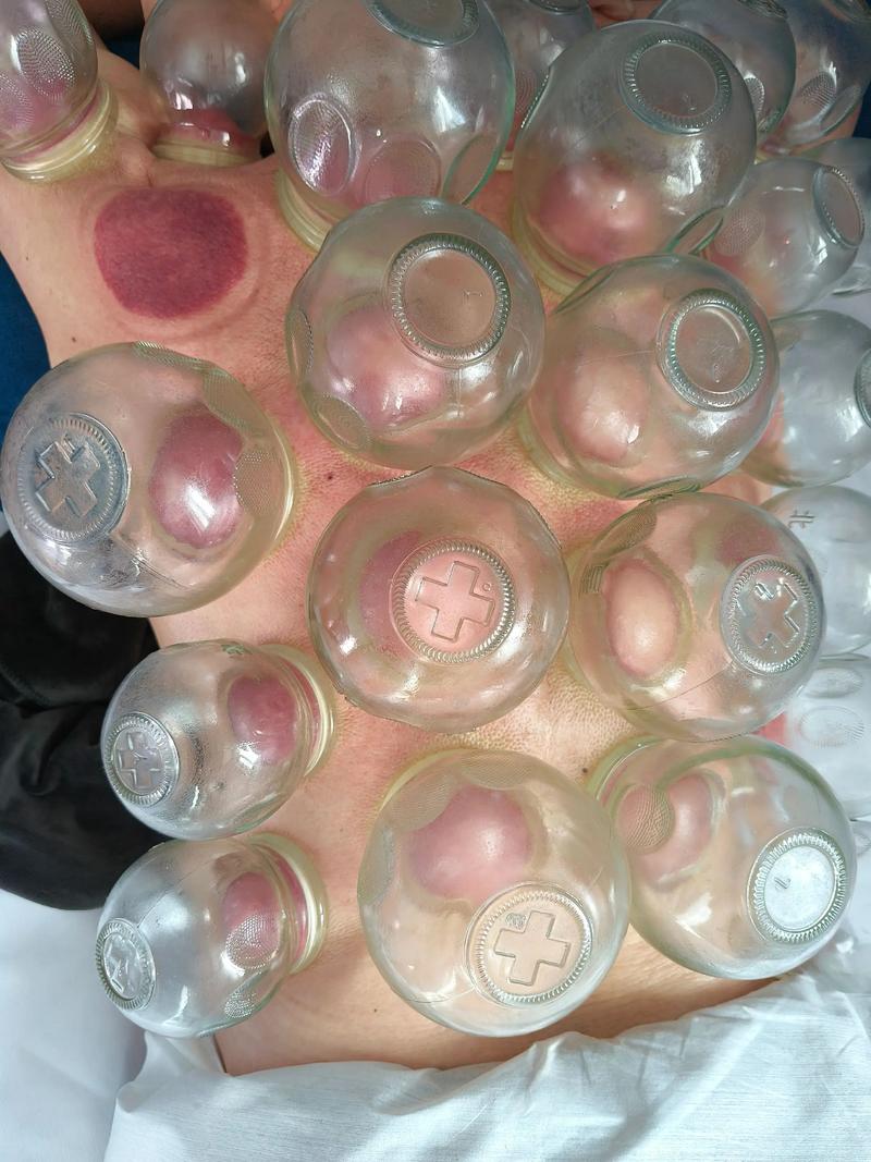 开封推拿按摩行业：传统技艺的现代化趋势解读